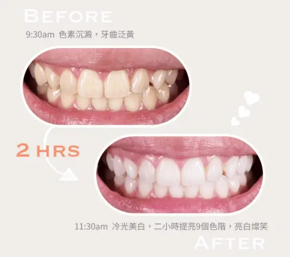 width=