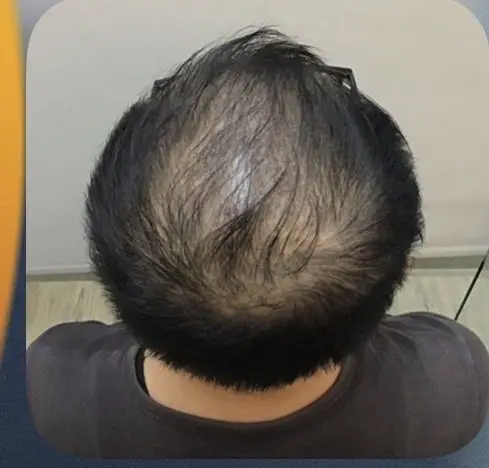 (風格有自然跟濃密兩種、須配合髮型才好看。不是每個人都適合紋髮